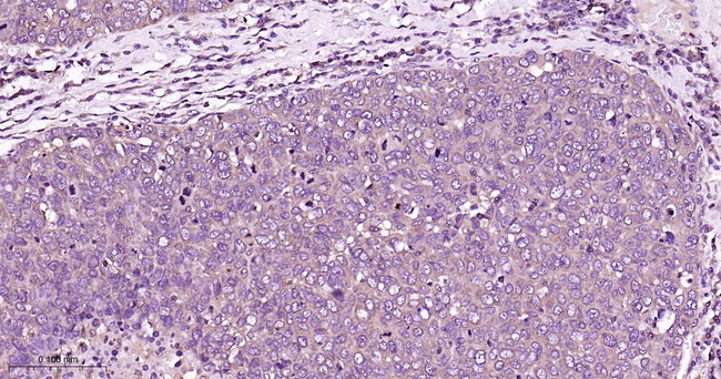 PKC alpha Antibody in Immunohistochemistry (Paraffin) (IHC (P))