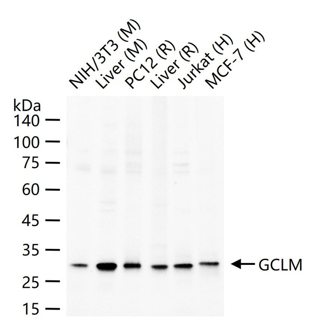 GCLM Antibody in Western Blot (WB)