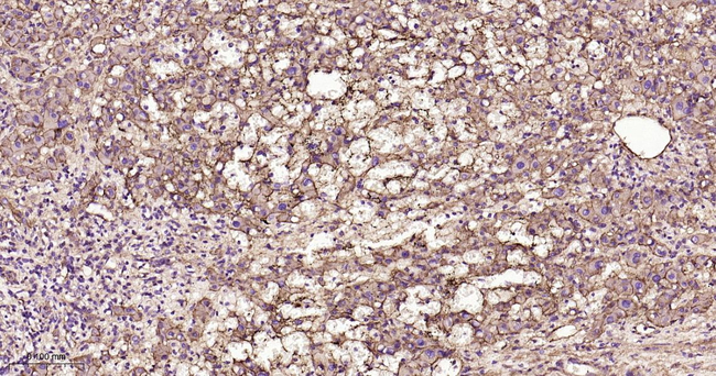 CD29 Antibody in Immunohistochemistry (Paraffin) (IHC (P))
