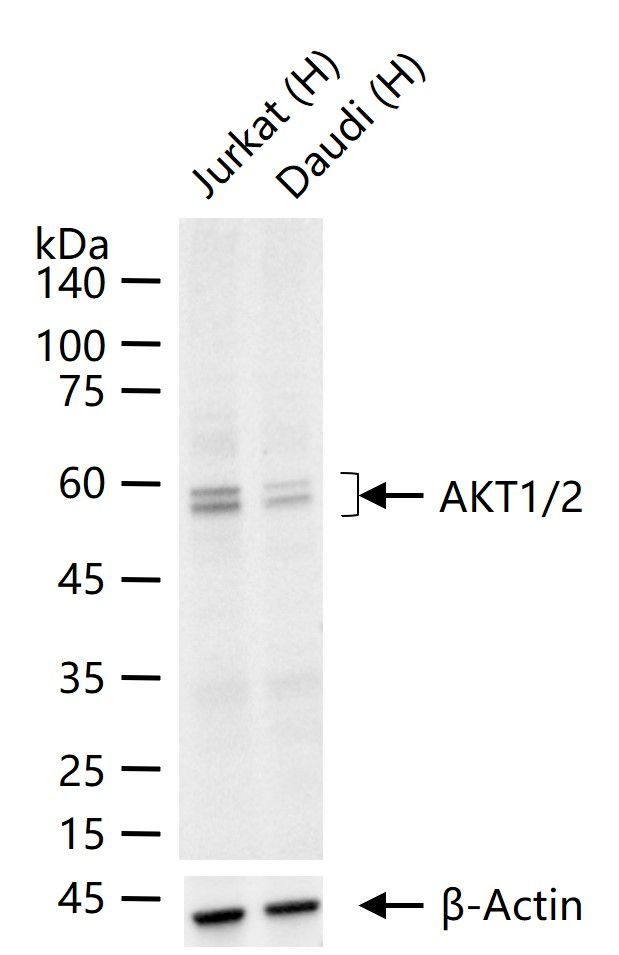 AKT1/AKT2 Antibody in Western Blot (WB)