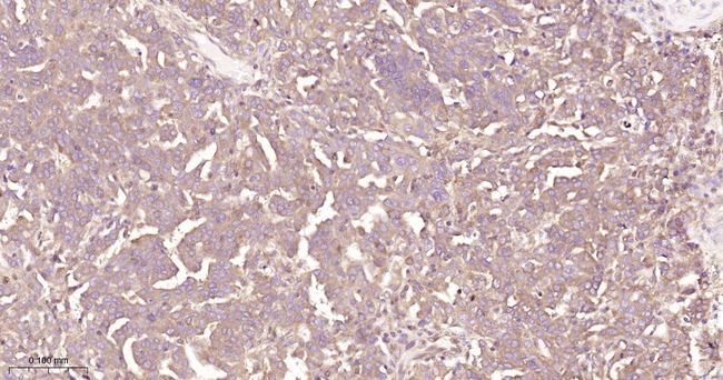 AKT1 Antibody in Immunohistochemistry (Paraffin) (IHC (P))