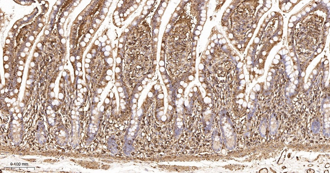 beta Actin Antibody in Immunohistochemistry (Paraffin) (IHC (P))