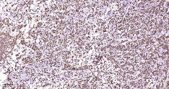SSEA1 Antibody in Immunohistochemistry (Paraffin) (IHC (P))