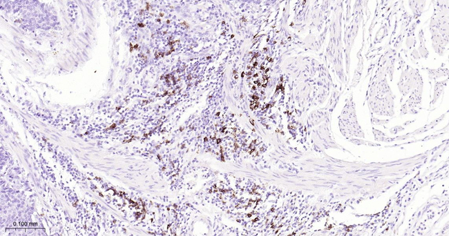 CD20 Antibody in Immunohistochemistry (Paraffin) (IHC (P))