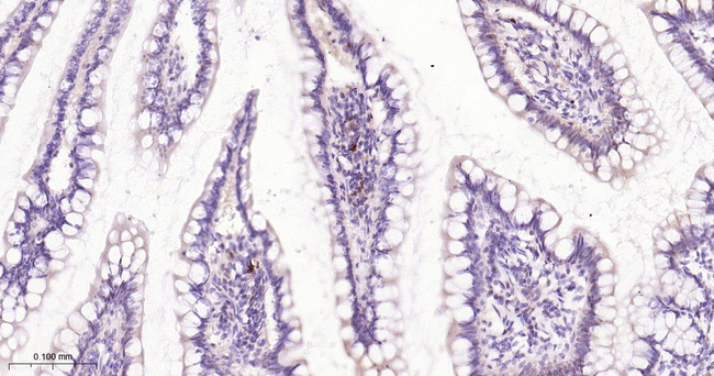 SQSTM1 Antibody in Immunohistochemistry (Paraffin) (IHC (P))