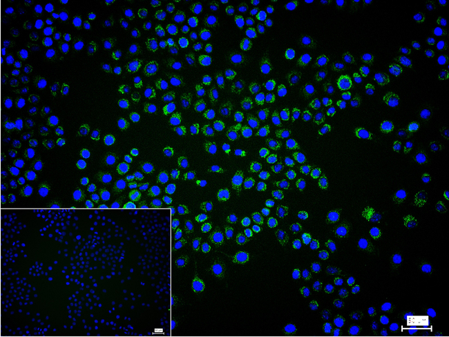 ACADM Antibody in Immunocytochemistry (ICC/IF)