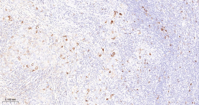 Cyclin B1 Antibody in Immunohistochemistry (Paraffin) (IHC (P))