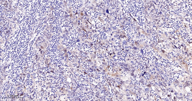 FOXO3A Antibody in Immunohistochemistry (Paraffin) (IHC (P))