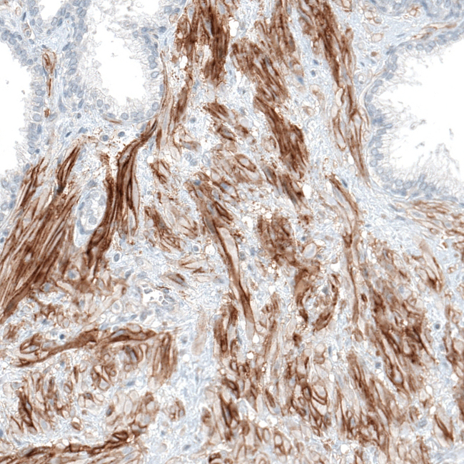 ITGA5 Antibody in Immunohistochemistry (Paraffin) (IHC (P))