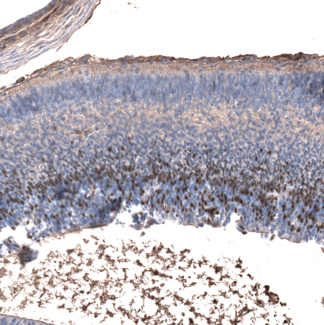 EOMES Antibody in Immunohistochemistry (Paraffin) (IHC (P))