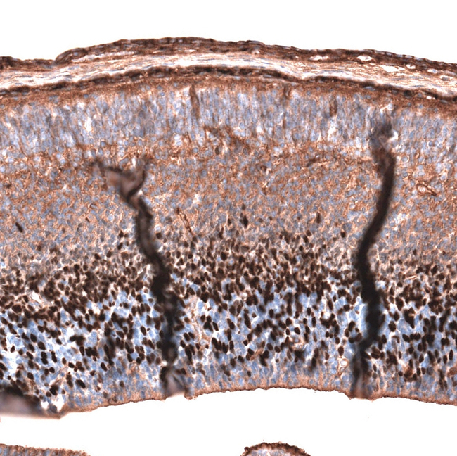 EOMES Antibody in Immunohistochemistry (Paraffin) (IHC (P))