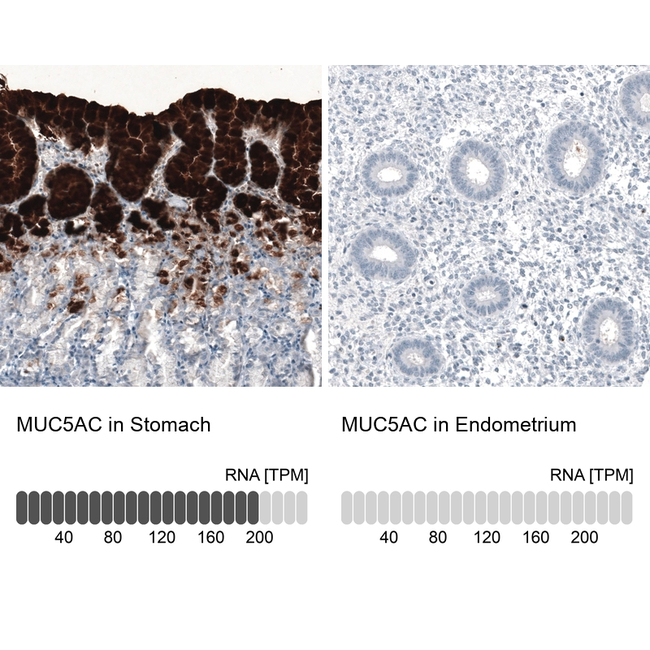 MUC5AC Antibody in Immunohistochemistry (Paraffin) (IHC (P))