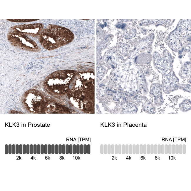 PSA Antibody in Immunohistochemistry (Paraffin) (IHC (P))