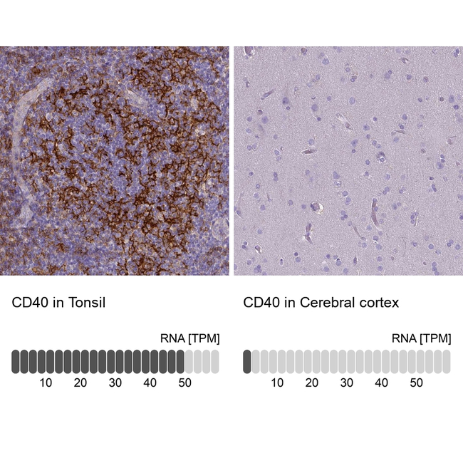 CD40 Antibody in Immunohistochemistry (Paraffin) (IHC (P))