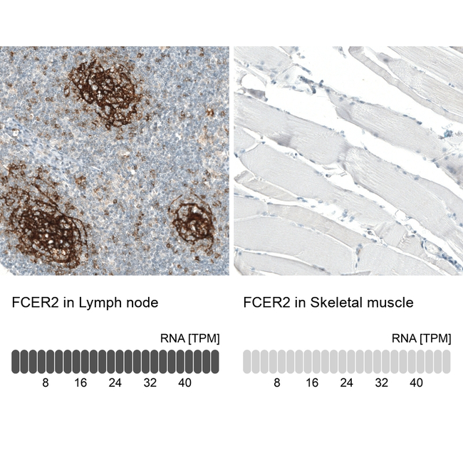 CD23 Antibody in Immunohistochemistry (Paraffin) (IHC (P))
