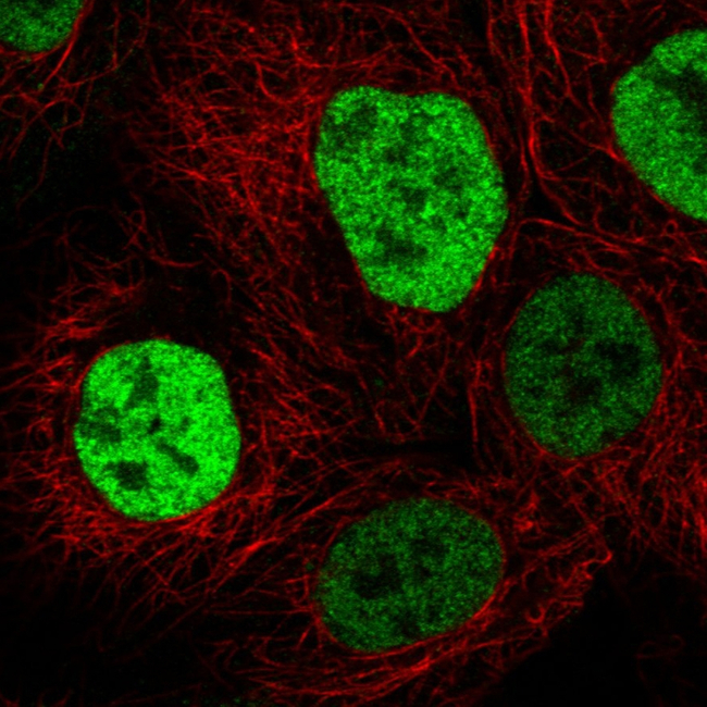 p53 Antibody in Immunocytochemistry (ICC/IF)