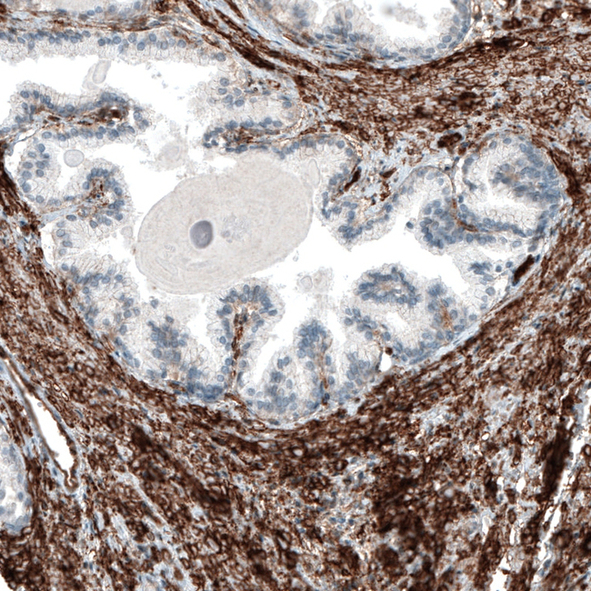 ITGA5 Antibody in Immunohistochemistry (Paraffin) (IHC (P))