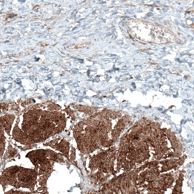 ITGA5 Antibody in Immunohistochemistry (Paraffin) (IHC (P))