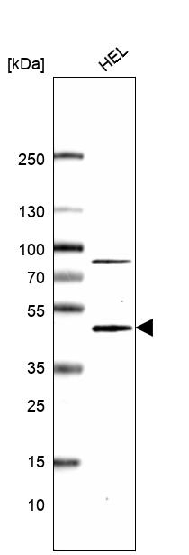 CMPK2 Antibody in Western Blot (WB)