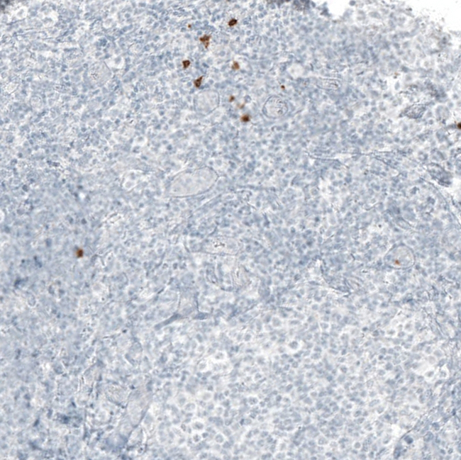 B3GAT1 Antibody in Immunohistochemistry (Paraffin) (IHC (P))
