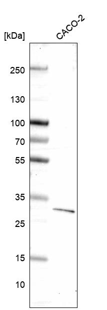 DKK1 Antibody in Western Blot (WB)