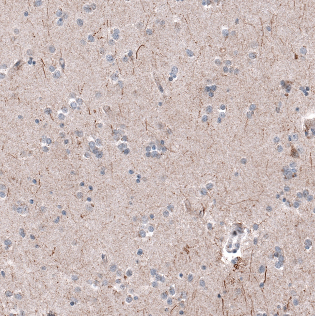 P2X7 Antibody in Immunohistochemistry (Paraffin) (IHC (P))