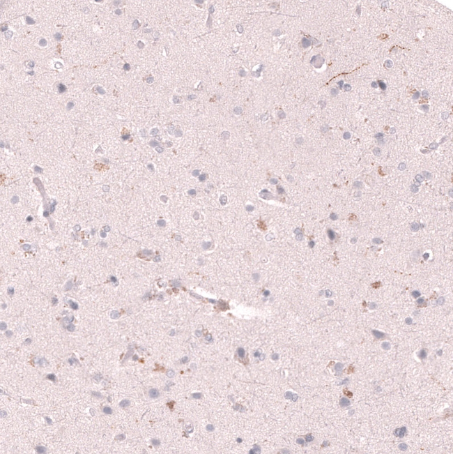 VMAT2 Antibody in Immunohistochemistry (Paraffin) (IHC (P))
