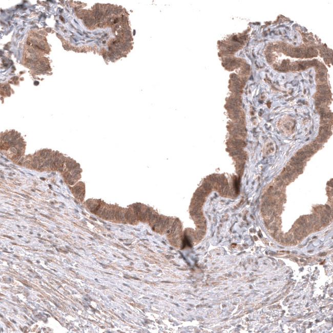 WNT5A Antibody in Immunohistochemistry (Paraffin) (IHC (P))