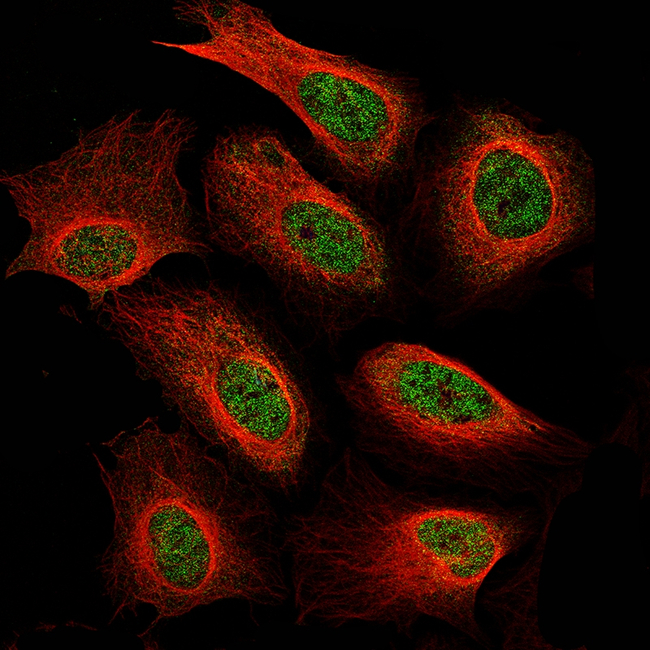 NF1 Antibody in Immunocytochemistry (ICC/IF)