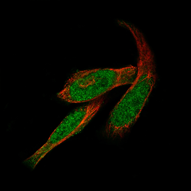 GLI1 Antibody in Immunocytochemistry (ICC/IF)