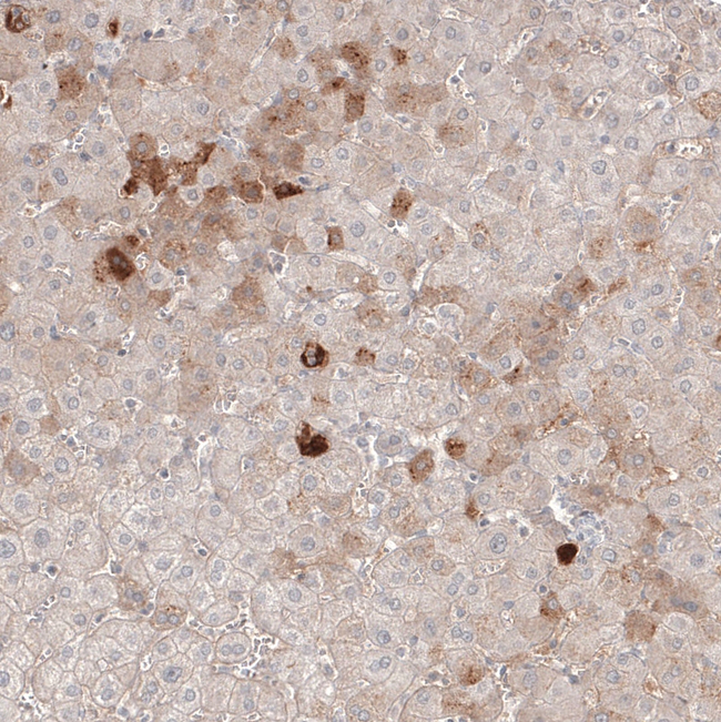 SAA Antibody in Immunohistochemistry (Paraffin) (IHC (P))