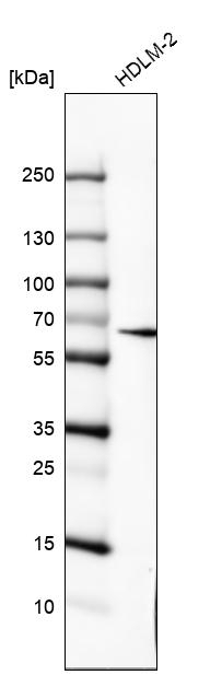 IL10RA Antibody in Western Blot (WB)