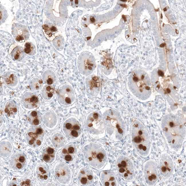 MUC2 Antibody in Immunohistochemistry (Paraffin) (IHC (P))