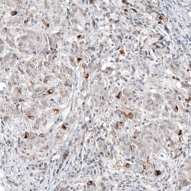 Mammaglobin A Antibody in Immunohistochemistry (Paraffin) (IHC (P))