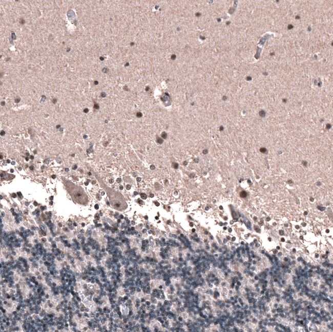 GLI1 Antibody in Immunohistochemistry (Paraffin) (IHC (P))