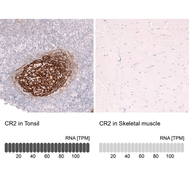 CD21 Antibody in Immunohistochemistry (Paraffin) (IHC (P))