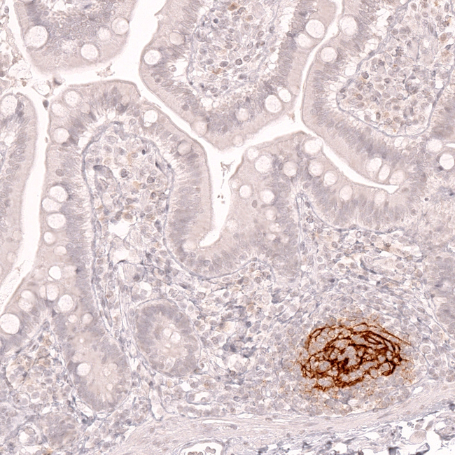 CD21 Antibody in Immunohistochemistry (Paraffin) (IHC (P))
