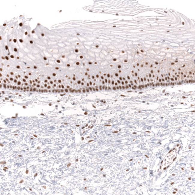 BRG1 Antibody in Immunohistochemistry (Paraffin) (IHC (P))