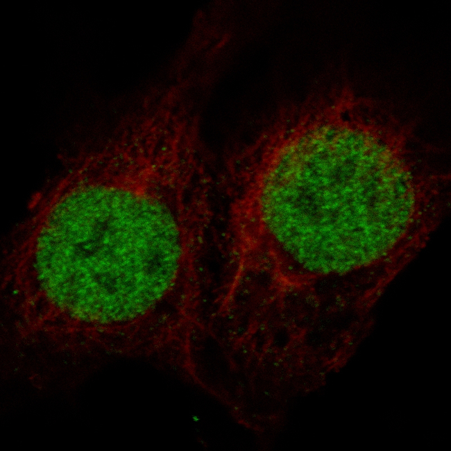 MSH2 Antibody in Immunocytochemistry (ICC/IF)