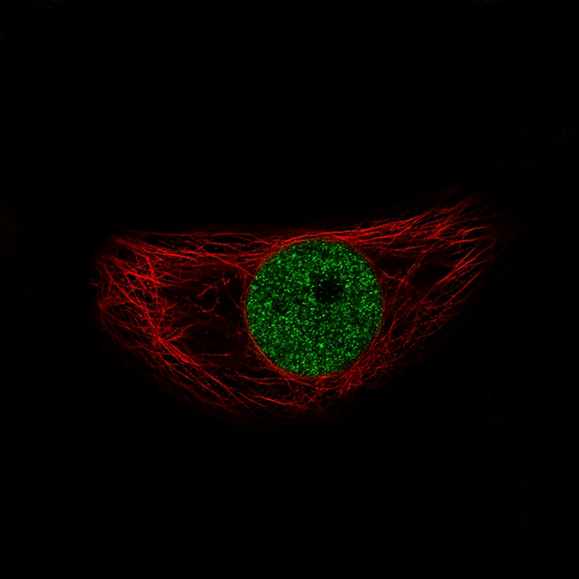 SNAIL Antibody in Immunocytochemistry (ICC/IF)