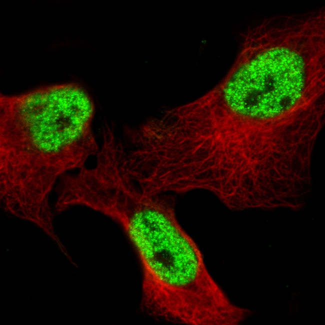 BCL6 Antibody in Immunocytochemistry (ICC/IF)