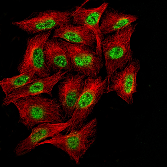 BCL6 Antibody in Immunocytochemistry (ICC/IF)