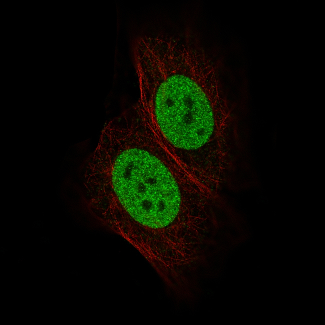 GATA3 Antibody in Immunocytochemistry (ICC/IF)