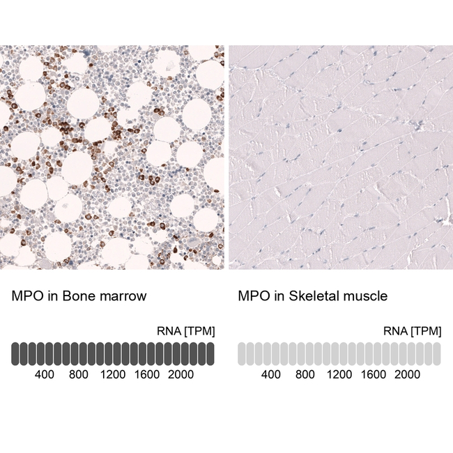 Myeloperoxidase Antibody in Immunohistochemistry (Paraffin) (IHC (P))