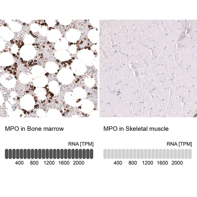 Myeloperoxidase Antibody in Immunohistochemistry (Paraffin) (IHC (P))