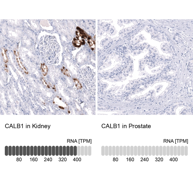 Calbindin D28K Antibody in Immunohistochemistry (Paraffin) (IHC (P))