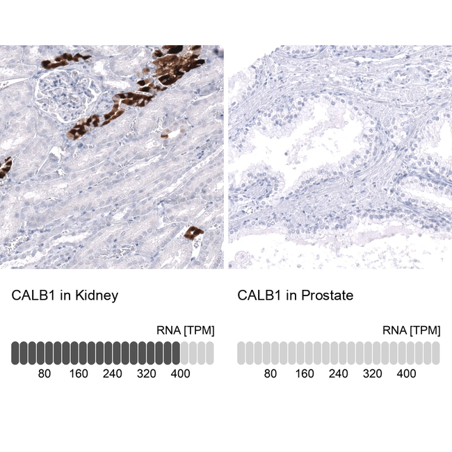 Calbindin D28K Antibody in Immunohistochemistry (Paraffin) (IHC (P))