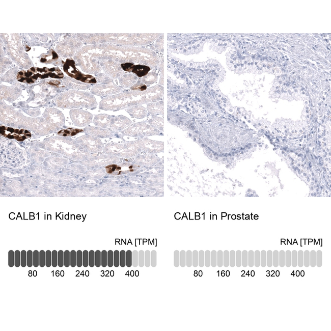 Calbindin D28K Antibody in Immunohistochemistry (Paraffin) (IHC (P))