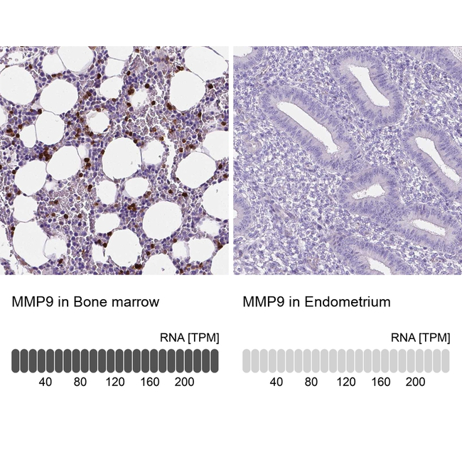 MMP9 Antibody in Immunohistochemistry (Paraffin) (IHC (P))