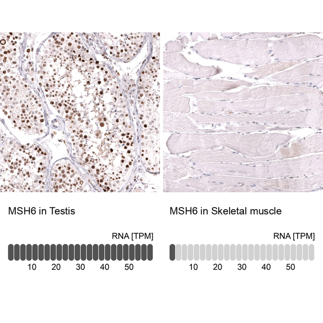MSH6 Antibody in Immunohistochemistry (Paraffin) (IHC (P))